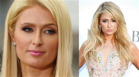 Paris Hilton Nase Job Plastische Chirurgie Vor Und Nach Nasenkorrektur Fotos Plastische Chirurgie