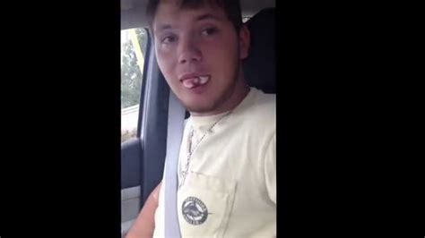 Funny Proposal After Dental Surgery Four Wisdom Teeth Pulled Youtube