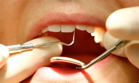 We did not find results for: 'Dental care mandatory within health insurance' - GulfToday
