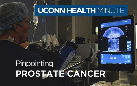 Pinpointing Prostate Cancer Uconn Today