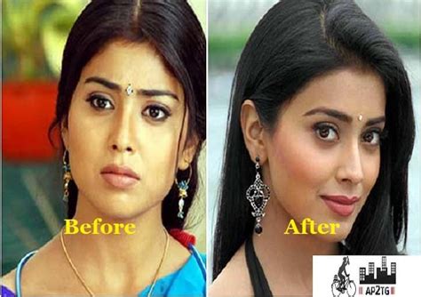 Samantha Ruth Prabhu Before After Plastic Surgery