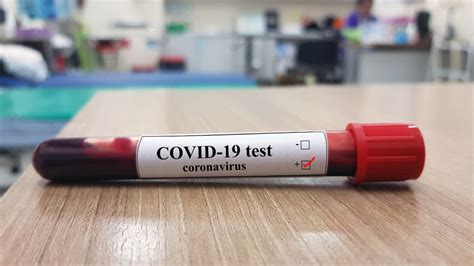 Fda Greenlights Labcorp Test That Can Diagnose Covid 19 In People