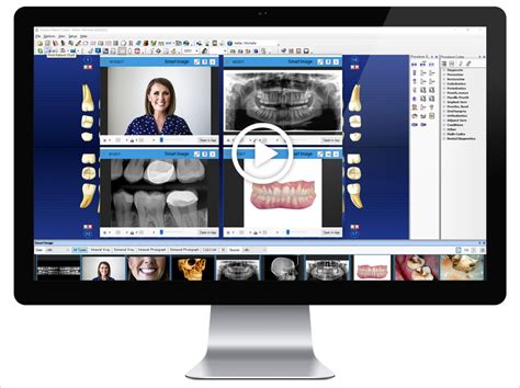 Dentrix G7 Upgrade Integrates Patient Charts With Imaging Solutions