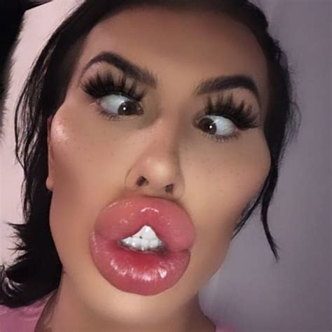Woman With Biggest Lips In The Uk Explains How She Makes Money Ghanamma Com