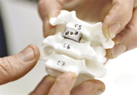 Renishaw Collaboration Demonstrates 3d Printing Capabilities For Spinal