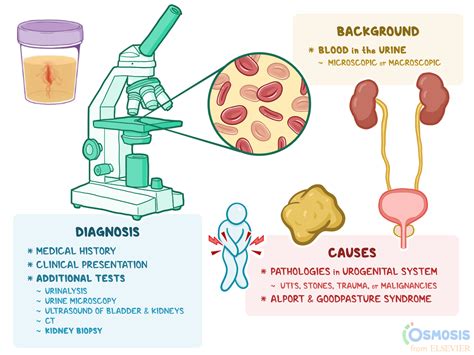 Hematuria What Is It Causes And More Osmosis