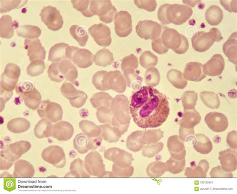 Eosinophil Cell Stock Image Image Of Monocyte Medical 100135451