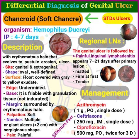 Chancroid Differential Diagnosis Of Genital Ulcers Ulcers