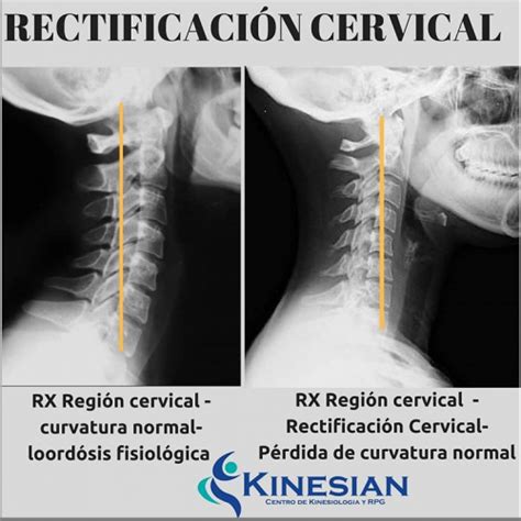 Simple Science: How to Make a Volcano with Kids