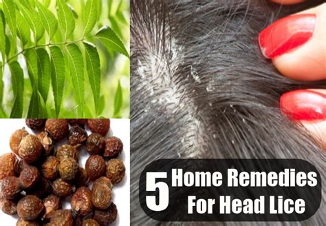 Head Lice Home Remedies Treatments And Cures Usa Uk Herbal Supplements