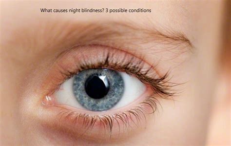Several types of blindness are spoken of. Heath Care: What causes night blindness? 3 possible conditions