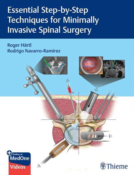 Essential Step By Step Techniques For Minimally Invasive Spinal Surgery