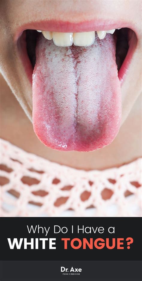 What are the possible causes of bumps under my tongue? Why Do I Have a White Tongue? Your Body's Trying to Tell ...