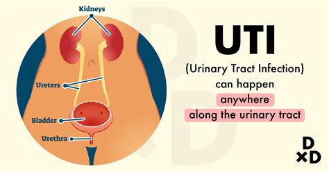 Urinary Tract Infection How To Identify And Treat Uti In Singapore Human
