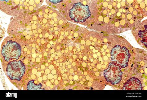 Pancreatic Secretory Cells Coloured Transmission Electron Micrograph