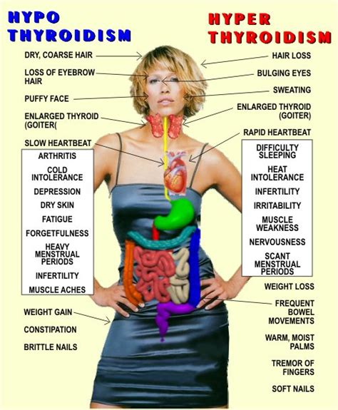Hypothyroidism Vs Hyperthyroidism Think Thyroid