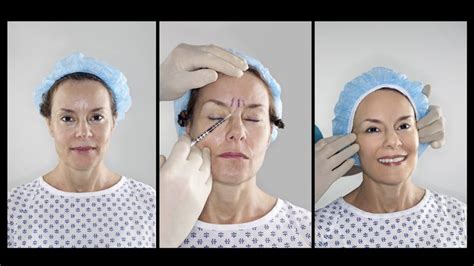 How Often To Get Botox Done People Often Get Confused With Botox And