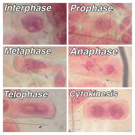 Microscope Labeled Stages Of Mitosis At Cara Weir Blog