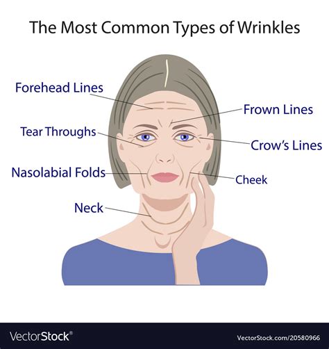 Common Types Of Facial Wrinkles Cosmetic Surgery Vector Image