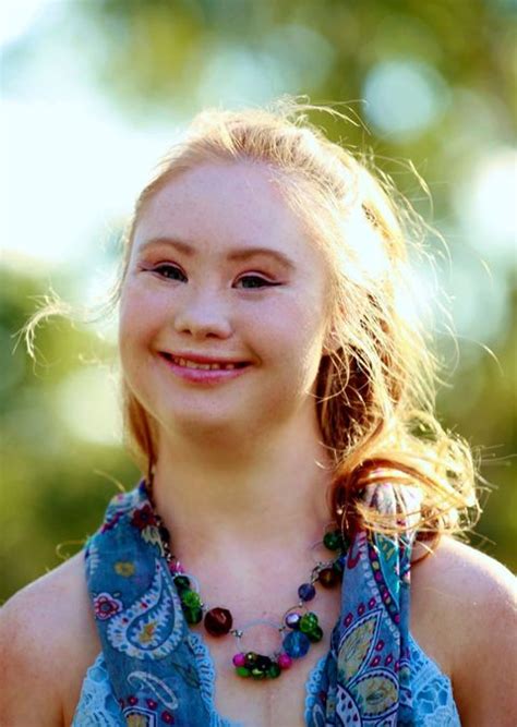 The Inspiring Teen With Down Syndrome Is Now A Legit Model