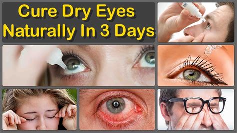 How To Get Rid Of Dry Eyes Naturally And Cure Chronic Dry Eyes
