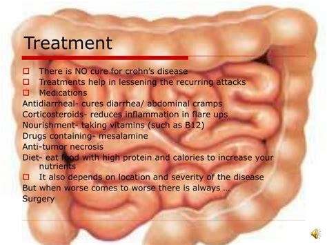 PPT - Crohn’s Disease PowerPoint Presentation - ID:4954621