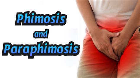 Phimosis And Paraphimosis Crash Medical Review Series Youtube