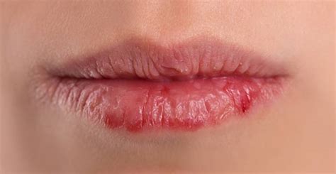 How Much Do You Know About Lip Care