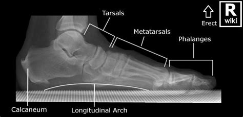 In particular, these techniques show the bones structures, ligaments, muscles and tendons, taking part to the arch setting. Radiographic Anatomy - Foot Lateral Weight Bearing ...