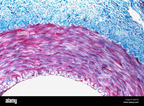 Muscular Artery Light Micrograph Of A Transverse Section Through The