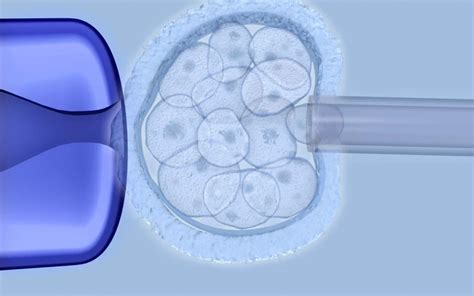 Preimplantation Genetic Diagnosis Novafiv Fertility Centre