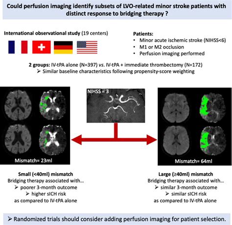 Perfusion Imaging And Clinical Outcome In Acute Minor Stroke With Large