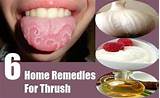Mouth Infection Home Remedies Pictures