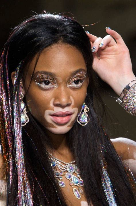 Vitiligo Model Beyonce Vitiligo Treatment Eye Makeup Hair Makeup