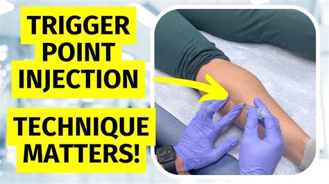 Trigger Point Injection Technique Matters Youtube