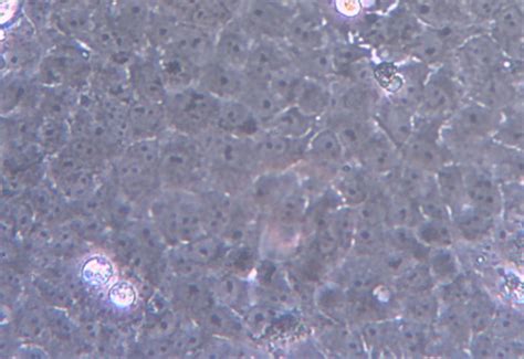 Formerly called cercopithecus aethiops, this group of monkeys has been split into several different species). A monolayer sheet of uninfected Vero E6 cells. The normal ...