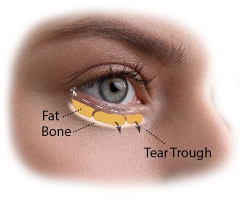 Blepharoplasty Eyelid Surgery Visage Facial Plastic Surgery