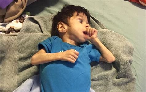 L'alimentazione del neonato e del bambino piccolo l'alimentazione del neonato e del bambino piccolo: Il corpicino scheletrico ricoperto di peli e due occhioni ...