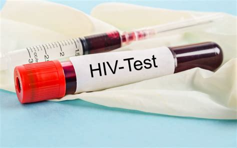 Knowing your status gives you powerful information to keep you and your partner. What You Need To Know About HIV RNA Test | YAPMT