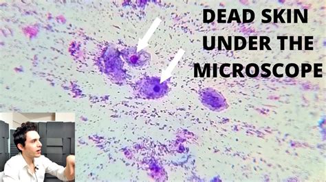 Update Dead Skin Under The Microscope Part 2 Youtube