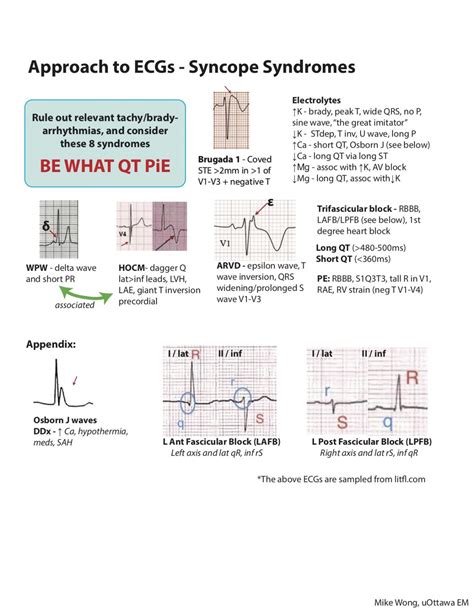 Approach To The Ecg Emottawa Blog