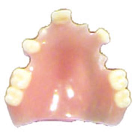They are made of acrylic and can break easily when dropped accidentally. Types of Ultrathin Dentures | Intelligent Dental