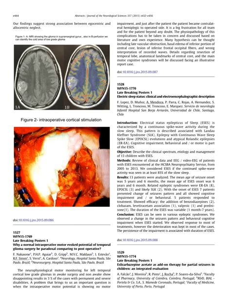 Pdf Eslicarbazepine Acetate As Add On Therapy For Partial Seizures In