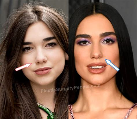 Dua Lipa Before And After 2022