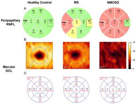 Ijms Free Full Text Optical Coherence Tomography And Magnetic