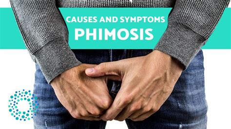 Phimosis Causes And Symptoms Youtube