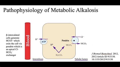 Metabolic Alkalosis Part 2 Pathophysiology And Mechanisms Youtube