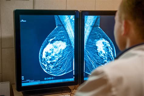 The Trans Mammogram Gap Large Numbers Of Trans People Arent Receiving