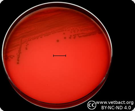 Enterococcus Faecium