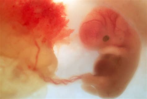 Development Of A Child Inside The Womb Hubpages